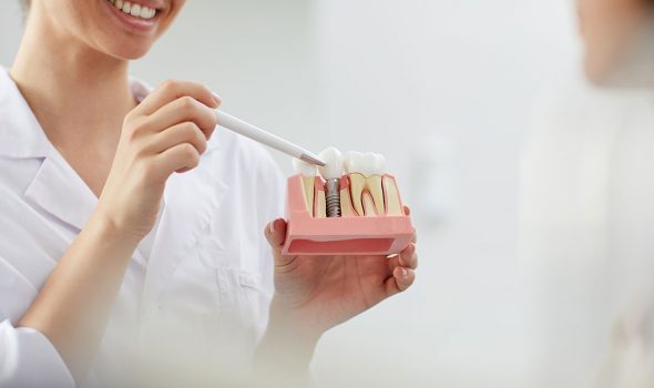 smiling-dentist-explaining-tooth-implantation-NUX947L