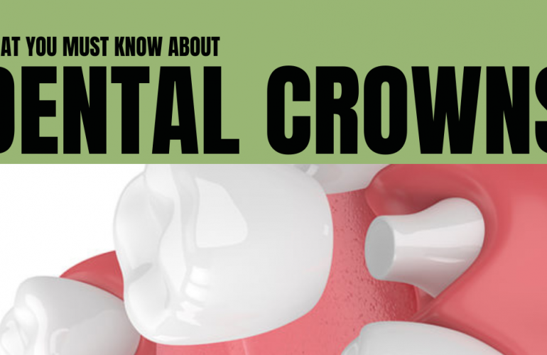 What You Must Know About Dental Crowns