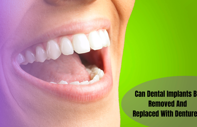 Dental Implants Be Removed And Replaced With Dentures
