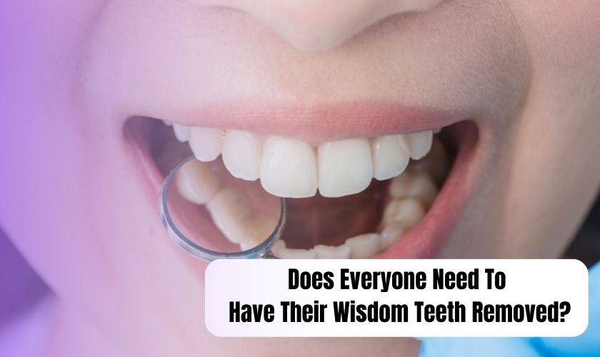 wisdom teeth removed